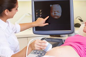 3D Ultrasound